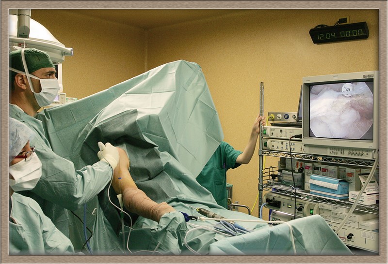 Chirurgia Artroscopica 2